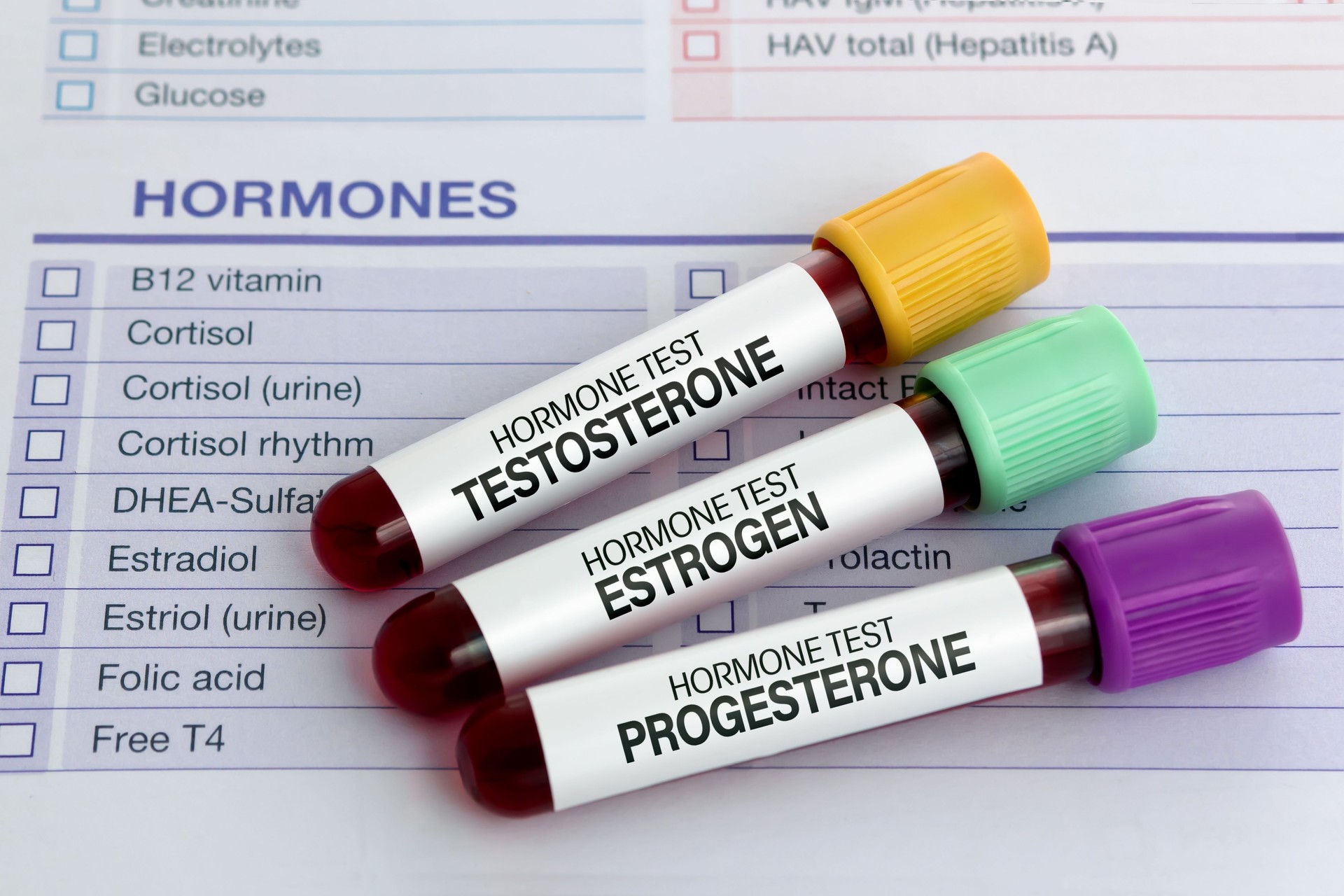 Blood test tubes for Testosterone, Estrogen and Progesterone analysis hormonal